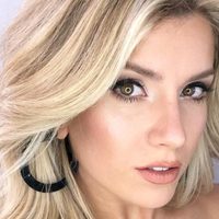 ¡Qué dolor! Laurita Fernández tuvo un accidente mientras cocinaba y se quemó la piel