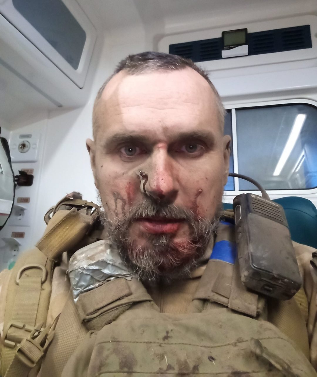 Oleg Sentsov herido
