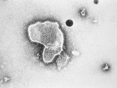 Qué hay tras el repunte de virus respiratorio en niños
