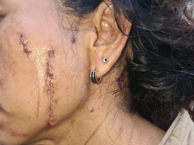 Sujeto casi mata a madre e hija, y para la fiscalía de Puebla solo se trató de un robo
