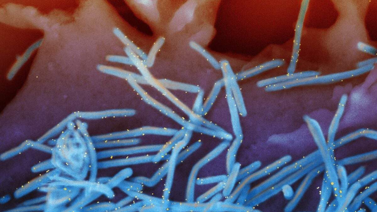 Esta imagen de microscopio electrónico provista por los Institutos Nacionales de Salud muestra viriones del virus respiratorio sincicial humano, coloreados de azul, y anticuerpos proteicos anti-VRS, coloreados de amarillo, derramándose de la superficie de células pulmonares humanas. Las personas mayores de 60 años pueden obtener una nueva vacuna contra el VRS, pero antes deben consultar a su médico, recomendaron las autoridades sanitarias de Estados Unidos