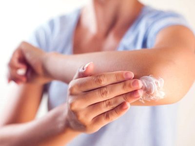 Basta de cremas carísimas, prepará en casa este remedio para evitar los codos resecos en invierno