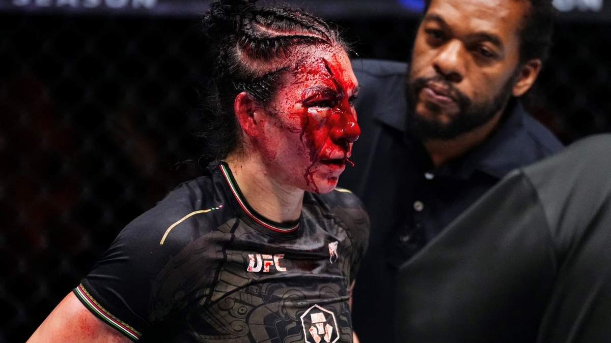 Irene Aldana sufre espeluznante corte en su rostro durante su pelea en la UFC