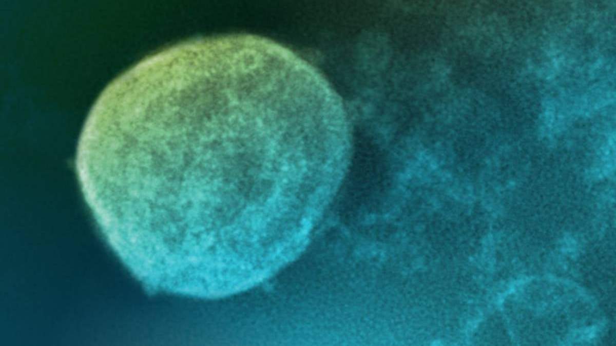 Representación gráfica de una partícula de virus Nipah