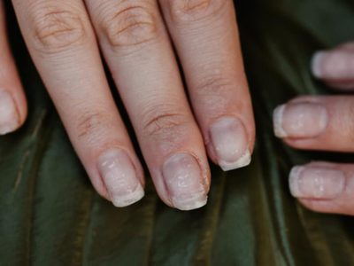 El alimento muy común que tenés en la cocina y que te ayudará a no tener más las uñas quebradizas