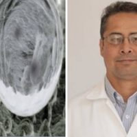 Mexicanos desarrollan un nanocompuesto que podría evitar el contagio de enfermedades en hospitales