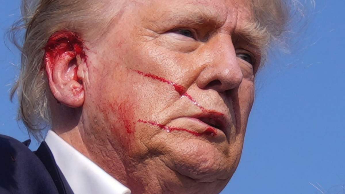 El expresidente estadunidense, Donald Trump herido en atentado