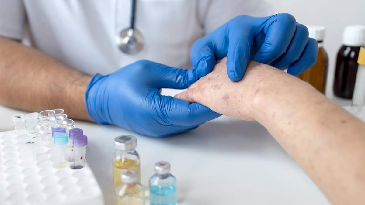 Preocupante: en 2025 hubo más de 46.000 casos de sífilis en Argentina