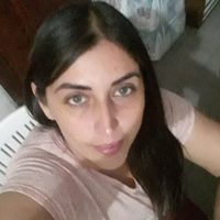 Claudia, la mujer que perdió el cartílago de la nariz por una prueba covid
