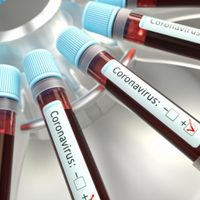Coronavirus: se notificaron 7 nuevos casos positivos en Neuquén