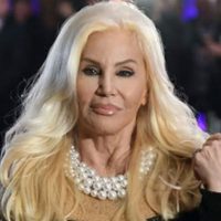 Tras su caída, Susana Giménez contó detalles de su estado de salud y dio un consejo a sus fans