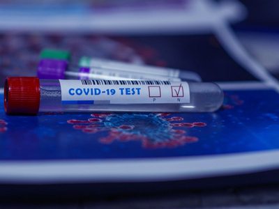 "Ataca al sistema nervioso": revelación sobre el coronavirus en Neuquén