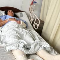 Buscan repatriar a una argentina que cayó de un tercer piso en México