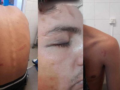 Brutalidad policial en Junín de los Andes: cinco jóvenes denunciaron una golpiza por parte del GEOP