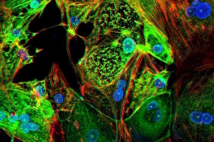 Las células T siguen reconociendo la variante ómicron, según un estudio del Instituto Karolinska (Suecia)