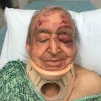 Sufre accidente automovilístico el abuelo del gobernador de Chiapas