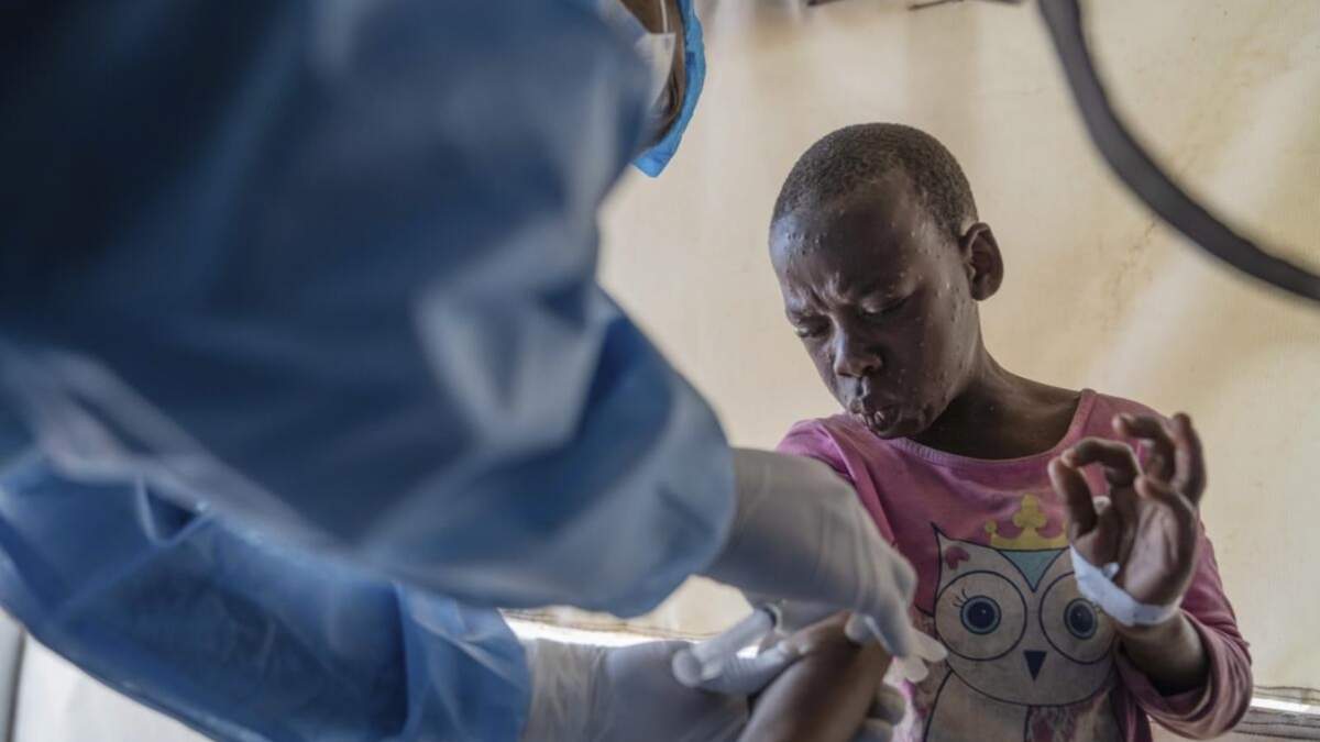 Un trabajador sanitario atiende a un paciente con viruela símica en un centro de tratamiento en Munigi, en el este de la República Democrática del Congo