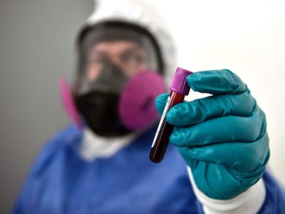 La CDMX participa en un ensayo clínico de tratamiento para covid-19