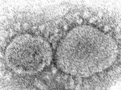 Origen del covid-19 sigue siendo un misterio
