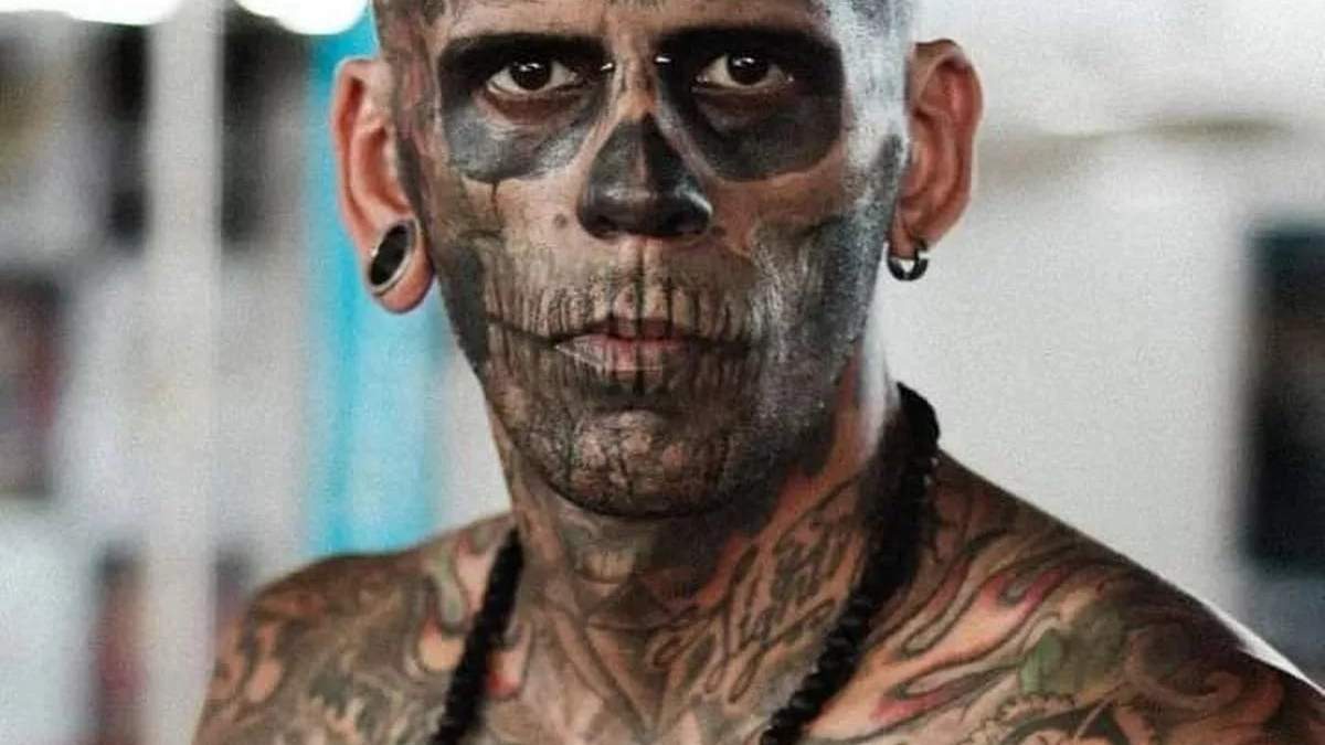 El hombre "más tatuado del mundo" mostró su rostro tras realizarse un tratamiento con laser