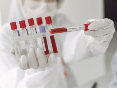 "Diagnóstico de coronavirus": le piden a las obras sociales que cubran los tests