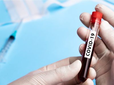 Loncopué: el coronavirus analizado a través de 70 testeos