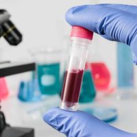 El grupo sanguíneo 0 sería menos vulnerable al coronavirus: nuevos estudios