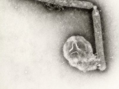 OMS afirma que el riesgo de transmisión de gripe aviar "sigue siendo bajo" después de muerte en EU