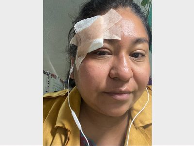 Tras ser agredida en Iguala, la activista Yolitzin Jaimes anuncia que pedirá asilo en EU