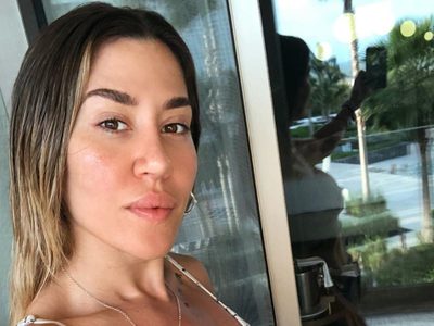 ¿¡Qué se hizo!? Jimena Barón mostró su cara totalmente cambiada y estallaron las redes