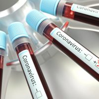 ¡Atención! "Nuevo caso de coronavirus en Neuquén": preocupa el nexo epidemiológico