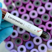 Diputado de Neuquén dio positivo de coronavirus