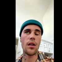 Así es el síndrome de Ramsay Hunt por el cual Justin Bieber no da conciertos