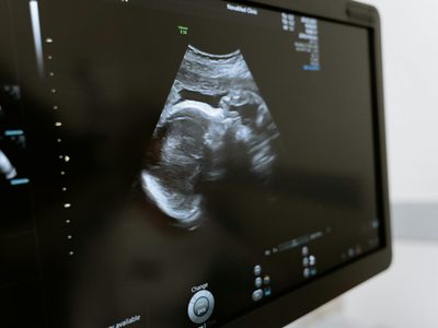 Cómo afecta la calidad de vida en la posibilidad de tener hijos