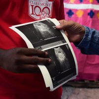 UNAM advierte aumento de infertilidad en 15% de las parejas