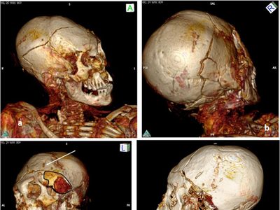 Las nuevas tecnologías lograron reconstruir la muerte violenta de dos momias de hace más de mil años
