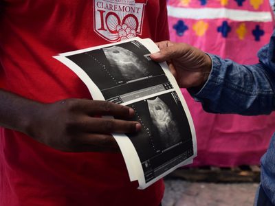 UNAM advierte aumento de infertilidad en 15% de las parejas