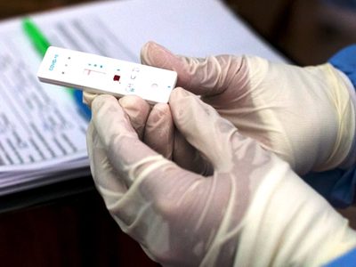 Diagnóstico veloz: cuándo pondrían a la venta el test nacional para detectar el coronavirus