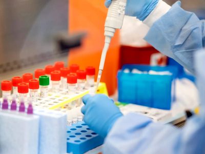 Las provincias ya están en condiciones para comenzar a diagnosticar el coronavirus