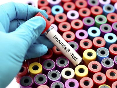 Por hepatitis, muere una persona cada 30 segundos en el mundo