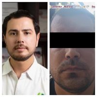 Detienen a "El Pantano" sospechoso del asesinato del líder limonero, Bernardo Bravo Manríquez