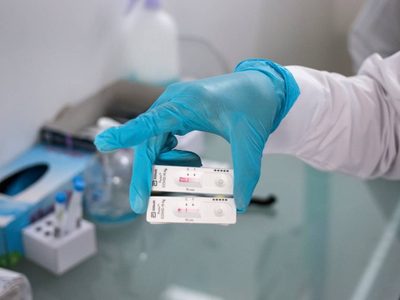 Ssa reporta este miércoles 43 muertos y 749 nuevos casos de covid-19 en México