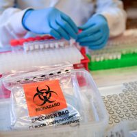 Coronavirus en Argentina: científicos avanzan en un tratamiento para curar a los enfermos