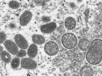 OMS confirma 80 casos de viruela del mono en 11 países