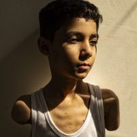 "¿Cómo podré abrazarte?": el retrato del niño gazatí con los brazos amputados, mejor foto del año