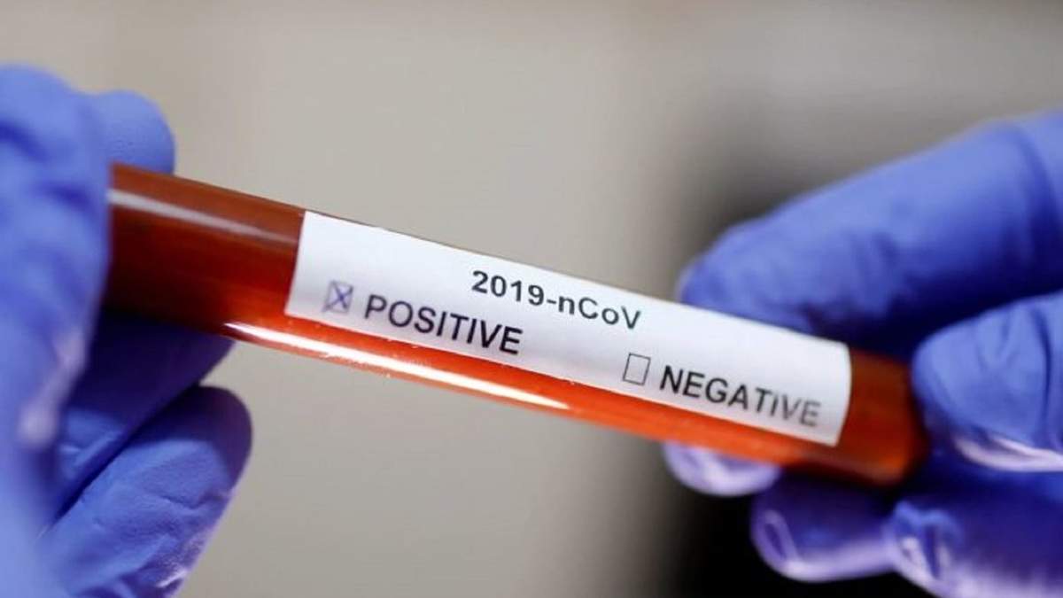 Coronavirus. Fuente: (Twitter)