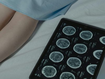Cáncer renal: detectado a tiempo, puede tratarse