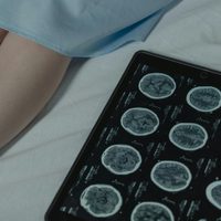 Cáncer renal: detectado a tiempo, puede tratarse