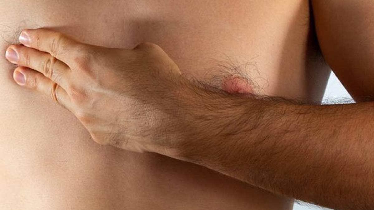 Cáncer de mama en hombres. Fuente: (Instagram)