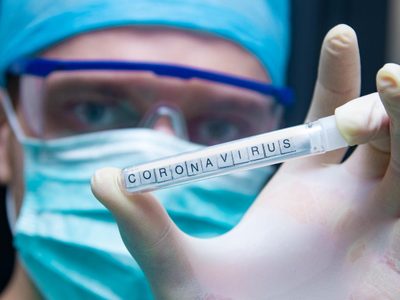 Coronavirus: detectan fallas en los tests que el Gobierno trajo de China